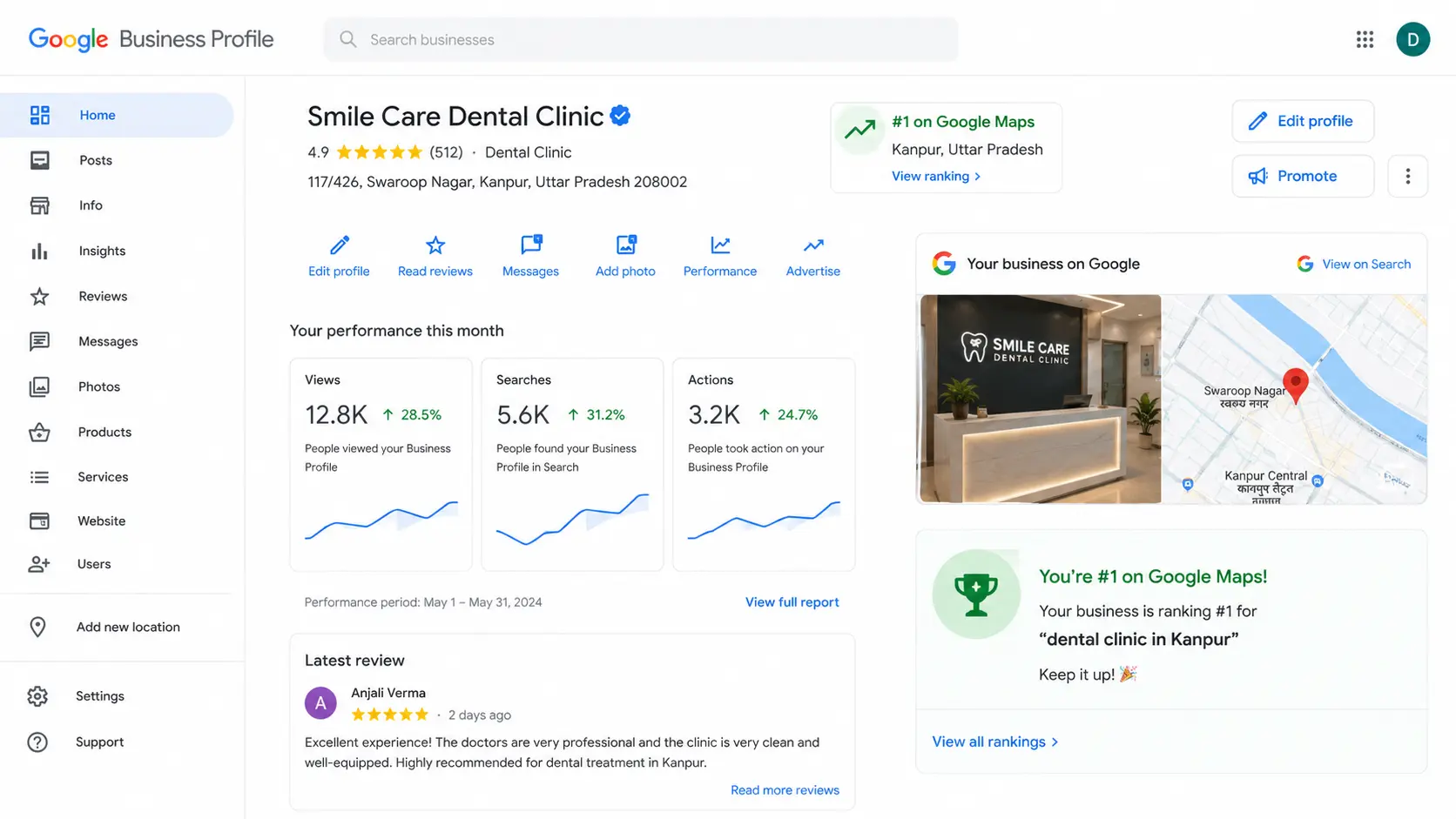Google Business Profile dashboard showing a dental clinic ranking #1 on Google Maps in Kanpur